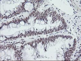 SOLO / SESTD1 Antibody (clone OTI2E7)