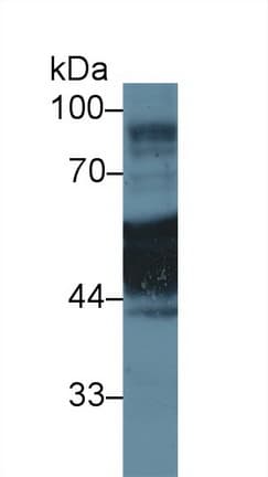 KRT1 / CK1 / Cytokeratin 1 Antibody (aa350-488)