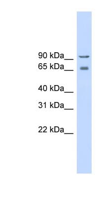 CACNB2 Antibody (aa215-264)