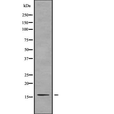 TP-2 / TNP2 Antibody