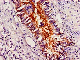 PLIN1 / Perilipin Antibody