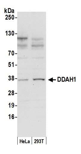 DDAH1 Antibody (aa175-225)