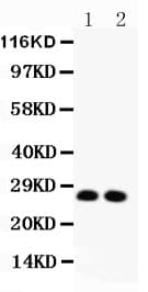 Polyclonal Rabbit anti-Human VEGFA / VEGF Antibody (aa27-191, IHC, WB)