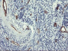 PECAM-1 / CD31 Antibody (clone OTI3G4)
