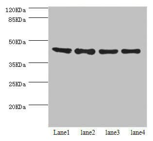 HERPUD1 / HERP Antibody