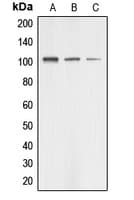 AASS / LKR / SDH Antibody (Internal)