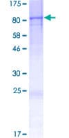Human DENND6B Protein (Recombinant GST)