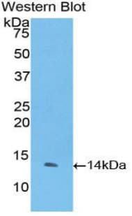 F7 / Factor VII Antibody (aa334-452)
