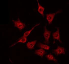 ARHGAP1 / CDC42GAP Antibody