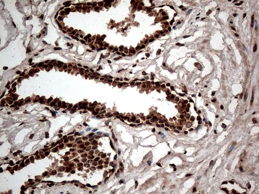 CDK15 / ALS2CR7 Antibody (aa293-378, clone OTI1E1)