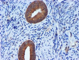 TIMP2 Antibody (clone OTI1A6, Carrier-free)