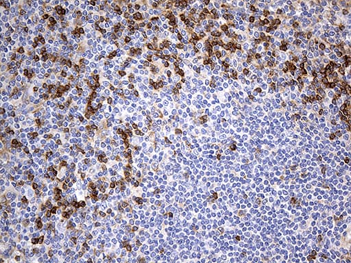 OPTN / Optineurin Antibody (clone OTI7H2)