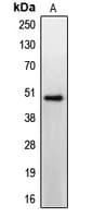CCKBR / Cckb Antibody (N-Terminus)