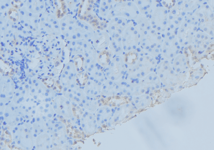 SAR1A / SAR1 Antibody
