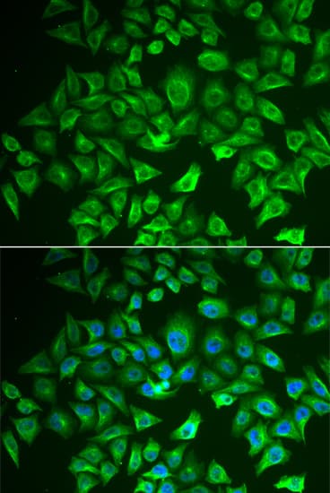 EHHADH / Enoyl-Coa Hydratase Antibody