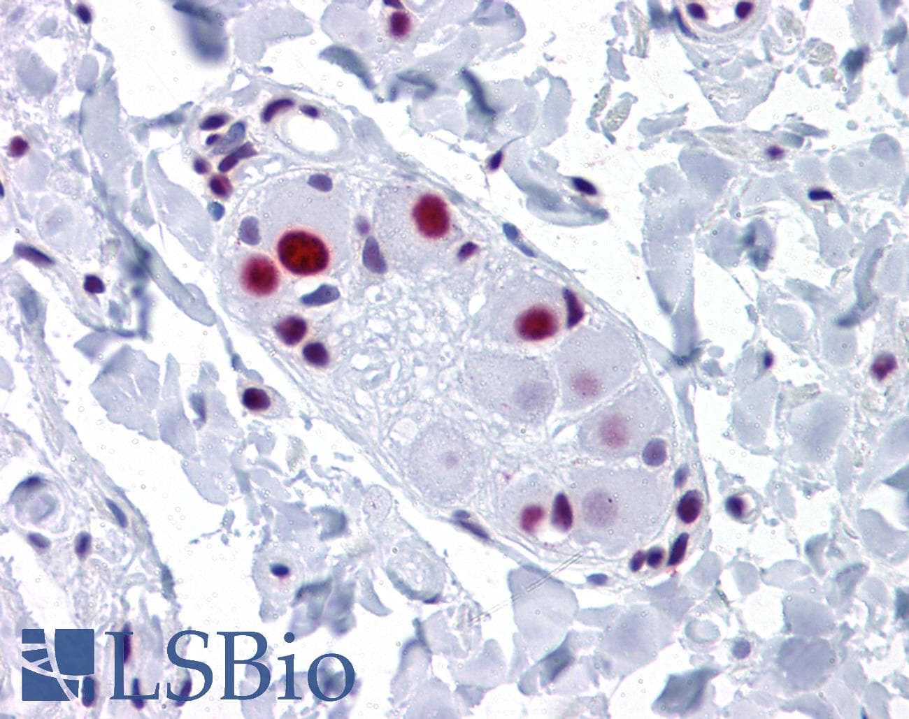 IHC-plus™ SNRPA / U1A Antibody (clone 3F9-1F7)