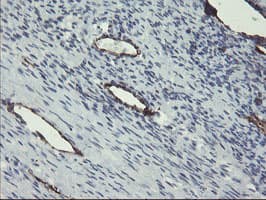 PECAM-1 / CD31 Antibody (clone OTI2B5)