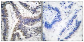 Polyclonal Rabbit anti-Human DFFA / ICAD / DFF45 Antibody (aa175-224, IHC)