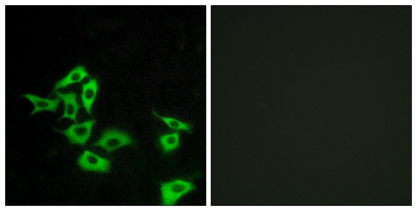 FZD8 / Frizzled 8 Antibody