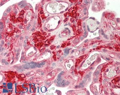 IHC-plus™ CORO1B Antibody (clone 3D10)