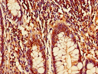 DTL / CDT2 Antibody