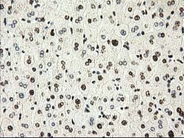 PYCRL Antibody (clone OTI8H6)
