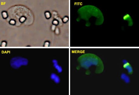 Monoclonal Mouse anti-Human ZEB1 / AREB6 Antibody (clone 4C4, IF, WB)