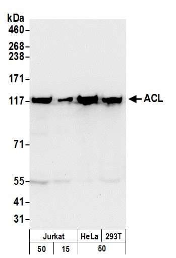 IHC-plus™ RPS3 / Ribosomal Protein S3 Antibody (aa193-243)