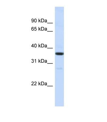 RMDN3 Antibody (aa23-72)