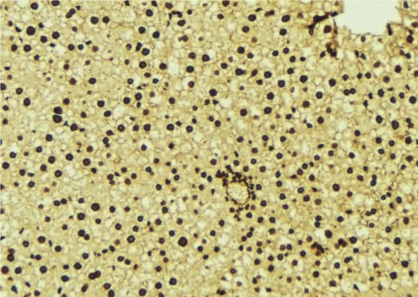 NR1H3 / LXR Alpha Antibody