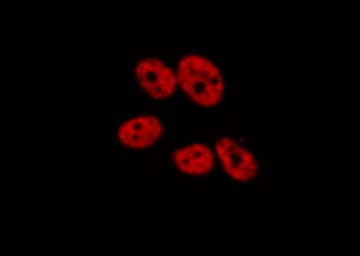 CSNK2A1 Antibody