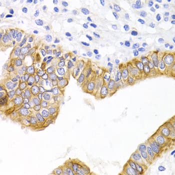 DRD1 / Dopamine Receptor D1 Antibody (aa338-446)