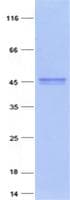Human XPA Protein (Recombinant Myc-DDK (Flag), C-terminus)