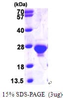 Human DUT / DUTPase Protein (Recombinant His)