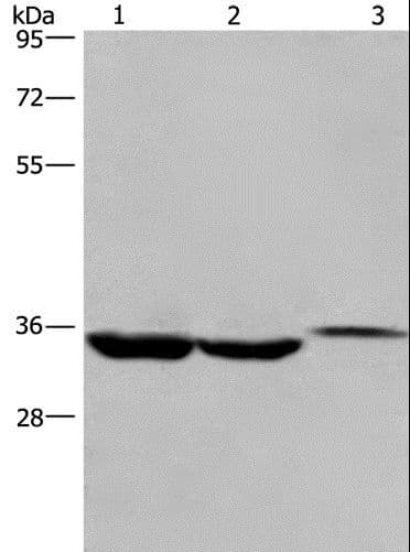 ING2 Antibody