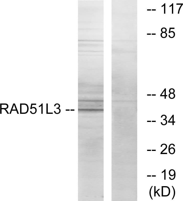 IHC-plus™ Polyclonal Rabbit anti-Human RAD51L3 / RAD51D Antibody (aa131-180, IHC, WB)