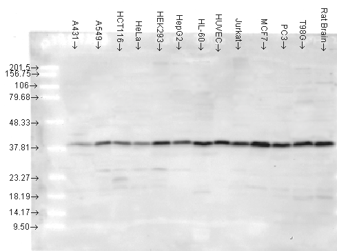 Polyclonal Rabbit anti-Human MAPK14 / p38 Antibody (IHC, WB)