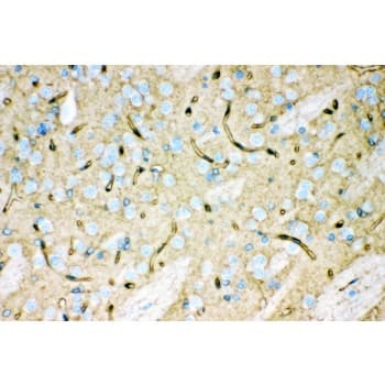 AQP4 / Aquaporin 4 Antibody (aa295-323)