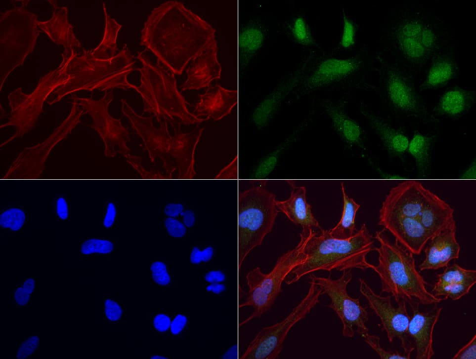 Monoclonal Mouse anti-Human PBX1 Antibody (clone UMAB111, IHC, IF)