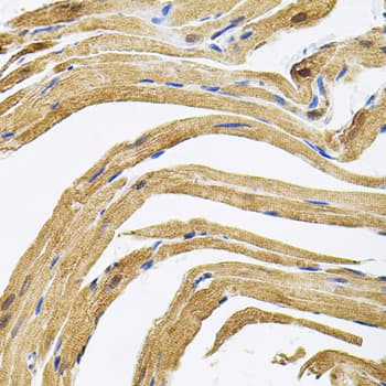 CEP164 Antibody
