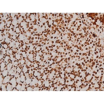 Polyclonal Rabbit anti-Human EZR / Ezrin Antibody (phospho-Tyr353, IF, WB)