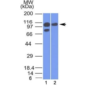 Alpha Catenin Antibody (clone 1G5)