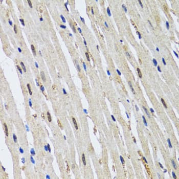 Polyclonal Rabbit anti-Human TP53BP1 / 53BP1 Antibody (IHC, IF, WB)