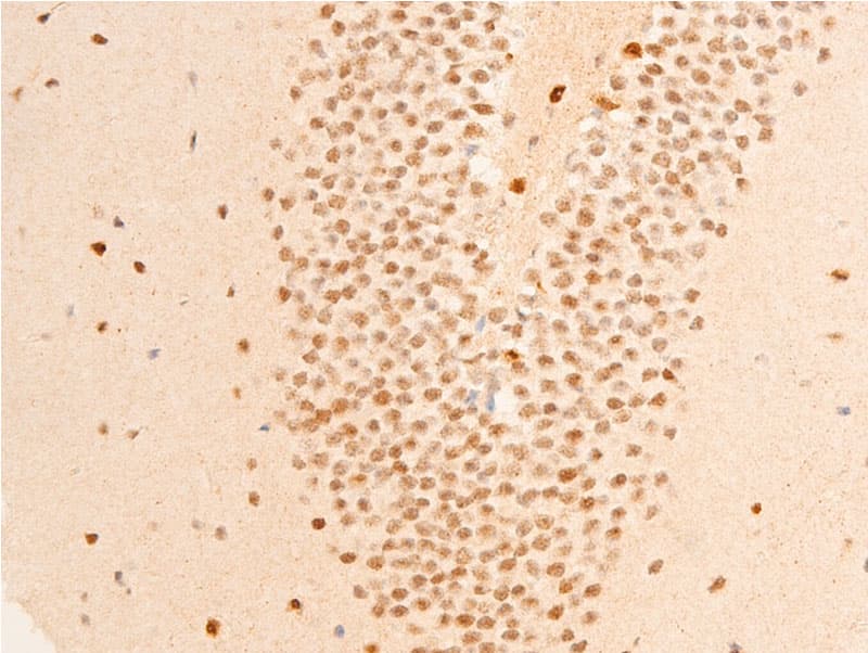 GSK3B / GSK3 Beta Antibody (phospho-Ser9)
