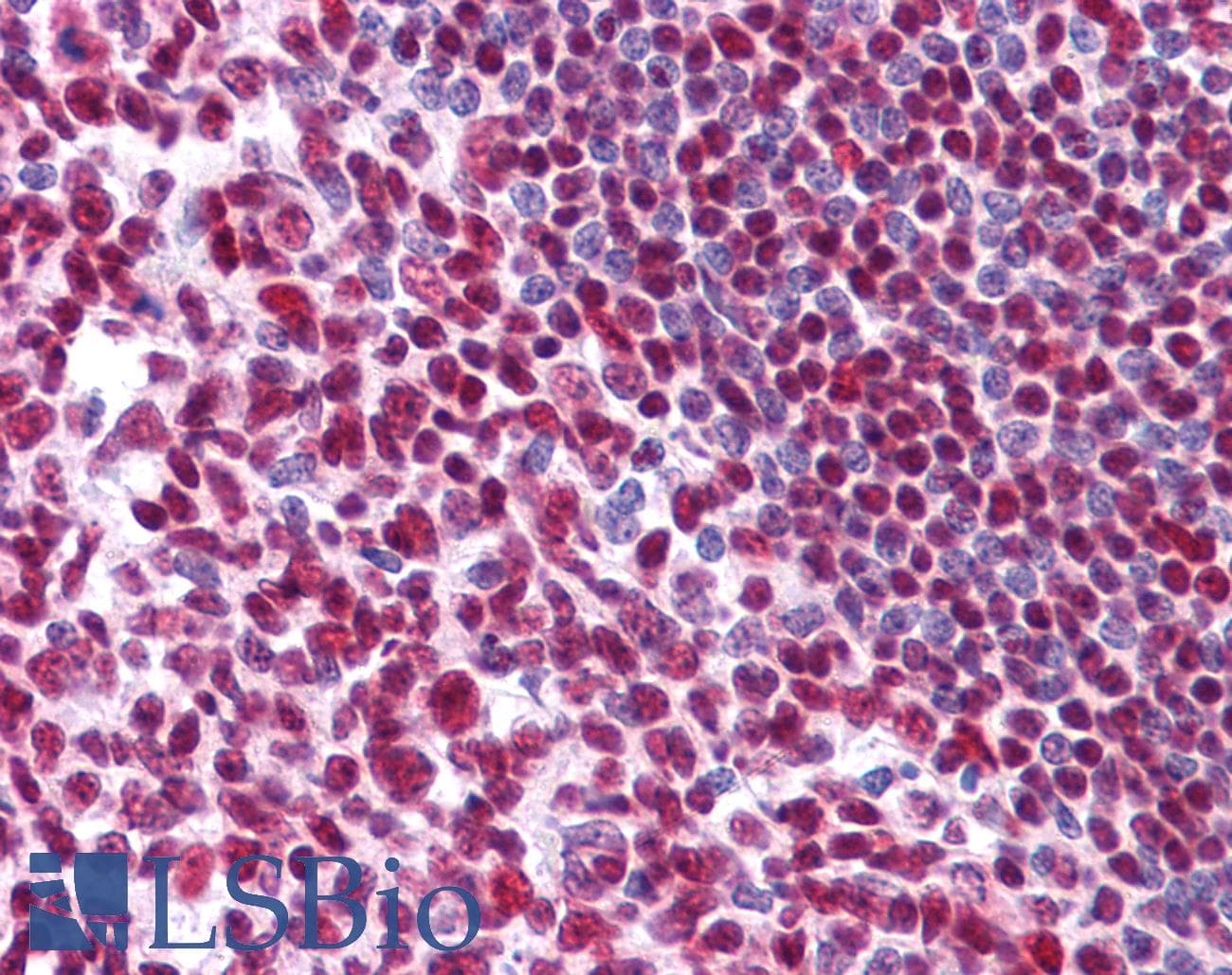 IHC-plus™ Monoclonal Mouse anti-Human MDM4 / MDMX Antibody (clone 2D10F4, aa 2-185, IHC, IF, WB)