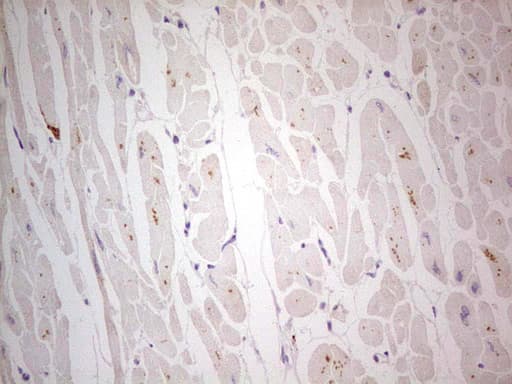 Monoclonal Mouse anti-Human NEFM / NF-M Antibody (clone OTI2G3, aa413-773, IHC, WB)
