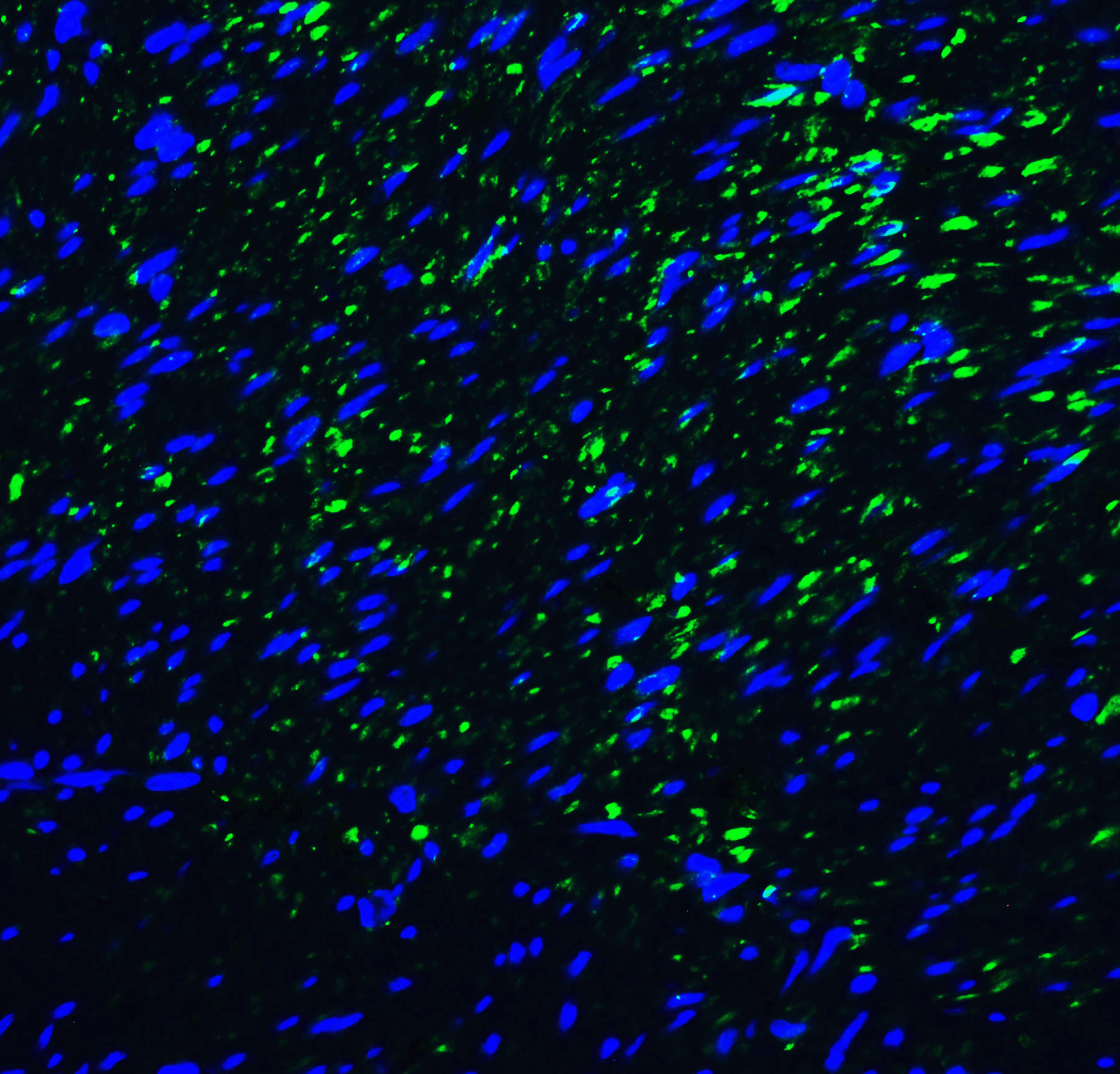 Monoclonal Mouse anti-Human HAVCR2 / TIM-3 Antibody (clone 1C6, IHC, IF)