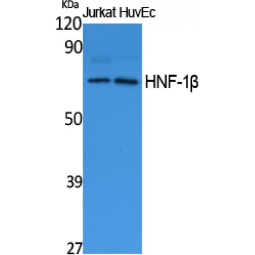 HNF1B / HNF1 Beta Antibody (N-Terminal)
