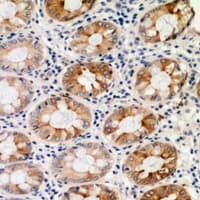 Polyclonal Rabbit anti-Human ASGR1 / ASGPR Antibody (IHC, WB)