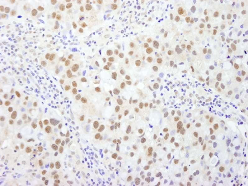 BAF53 / ACTL6A Antibody (aa25-75)
